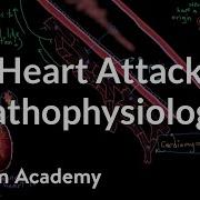 Heart Attack Myocardial Infarction Pathophysiology NCLEX RN Khan Academy