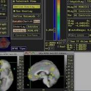 How To Set Specific P Values In AFNI