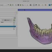 FOSS 3d Slicer AI Segmentation Of Mandible DentalSegmentator