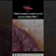 What Is A Muscle Spasm Causes Symptoms Quick Relief