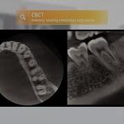 About RAYSCAN Alpha Plus Advanced Dental CBCT Imaging Solution