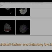 Hands On Computer Vision With Detectron2 5 Training Custom Object Detection Models