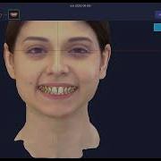 RAYFace SW Patient Data Reorientation Guide