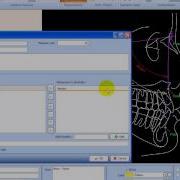 Ax CEPH Analysis Type Wizard Analysis Type From Scratch
