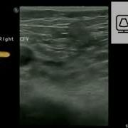 Ultrasound Physics