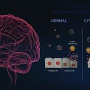 Covid Psychosis Understanding How The Virus Can Hijack The Brain
