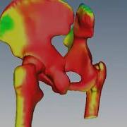 Statistical Shape Model Of The Hip Joint