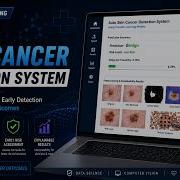 Автоматическая система обнаружения рака кожи с использованием ИИ и глубокого обучения Проект по