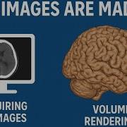How CT Brain 3D Images Are Made Volume Rendering Explained
