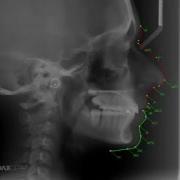 AudaxCeph