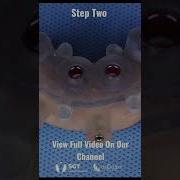 Step Two Properly Position The Surgical Guide