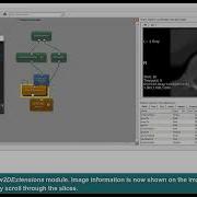 MeVisLab Tutorials Visualization Snapshots And Movies