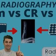 Film Vs CR Vs DR For Radiologic Technologists