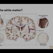 Introduction To Computational Neuroanatomy