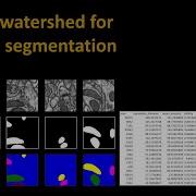 205 U Net Plus Watershed For Instance Segmentation