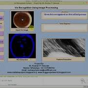 Iris Recognition And Classification Using Image Processing Matlab Project With Source Code