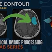 Snakes For Quick Image Segmentation Active Contour Tutorial