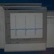 DIY PC ECG Using A Sound Card