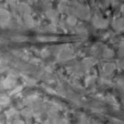 Cleaning The Mouse Retina For Patch Clamp Recording Uncut