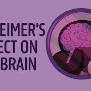 Why Is Alzheimer S Disease So Difficult To Treat Krishna Sudhir