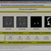 Matlab Code For Osterporosis Detection Using Image Processing