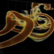 The Emergence Of Small Scales In Vortex Ring Collisions