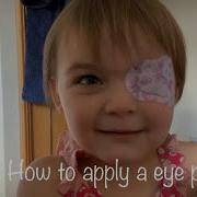 How To Apply An Eye Patch For A Lazy Eye Amblyopia