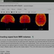 Tutorial On Machine Learning In Functional MRI Using Nilearn