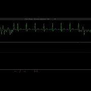 Simulated Patient Monitor