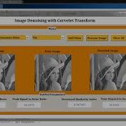 Image Denoising Using Curvelet Transform MATLAB Code MATLAB Project