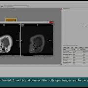 MeVisLab Tutorials Image Processing Arithmetic Operations