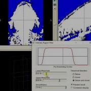 Mouse Organ Segmentation With ITK Snap Part 1