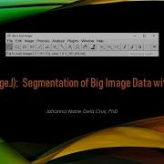FIJI ImageJ Segmentation Of Big Image Data With Labkit