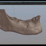 Mandible Segmentation With Teeth And Soft Tissues