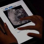 Remote Volume Rendering On An IPad