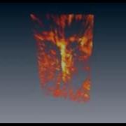 3 D Volume Rendering