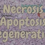 Necrosis Apoptosis And Regeneration Liver Pathology