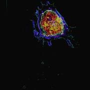 Apoptosis Programmed Cell Death Live And In 3D