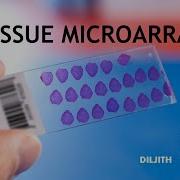 Tissue Microarray TMA