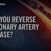 Can You Reverse Coronary Artery Disease