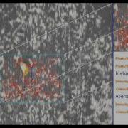 Finding Velocity Vector From Image Sequences Using Speeded Up Robust Features SURF