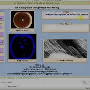 Iris Recognition Using Image Processing Full Matlab Project With Source Code