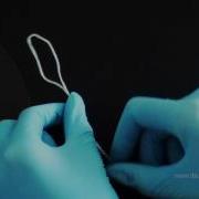 Self Tightening Double Ligature I