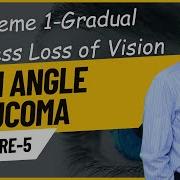 Open Angle Glaucoma Lecture 5
