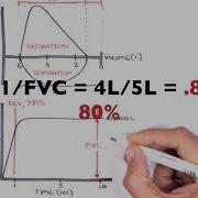 Understanding Spirometry Normal Obstructive Vs Restrictive