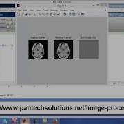 Matlab Code For 3D SPIHT Image Compression