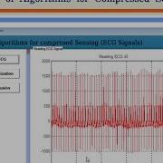 Fusion Of Algorithms For Compressed Sensing Matlab Project