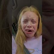 Why Getting Wisdom Teeth Removed Can Get You In TROUBLE