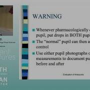 Approach To Anisocoria ARCHIVE
