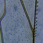 Honeybee Wing Under Microscope